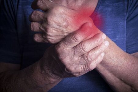 3 Rheumatoid Arthritis Natural Treatment Options Image